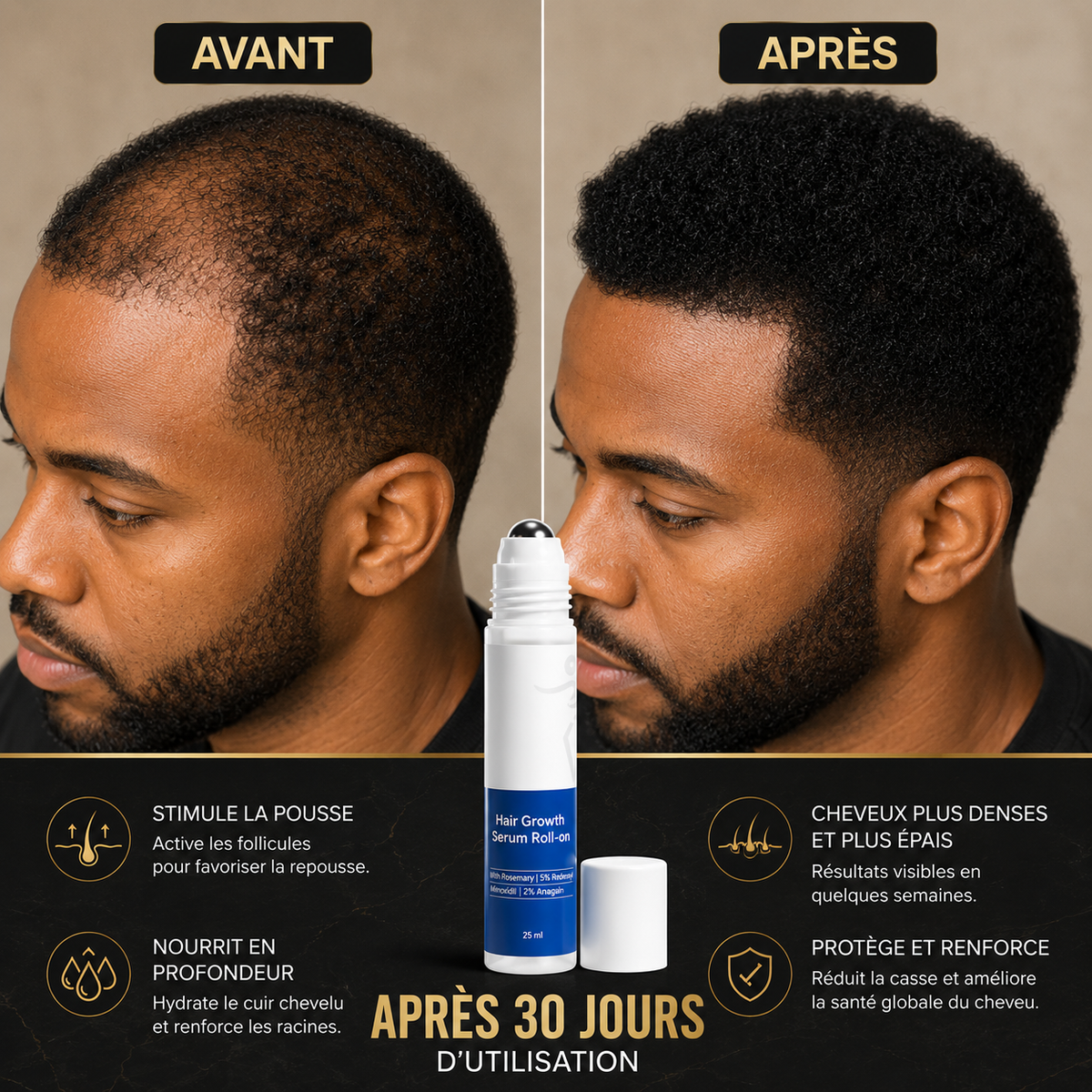 KERAVIVE™: Stoppez la chute de vos cheveux et retrouvez une chevelure plus dense naturellement.