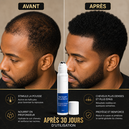 KERAVIVE™: Stoppez la chute de vos cheveux et retrouvez une chevelure plus dense naturellement.